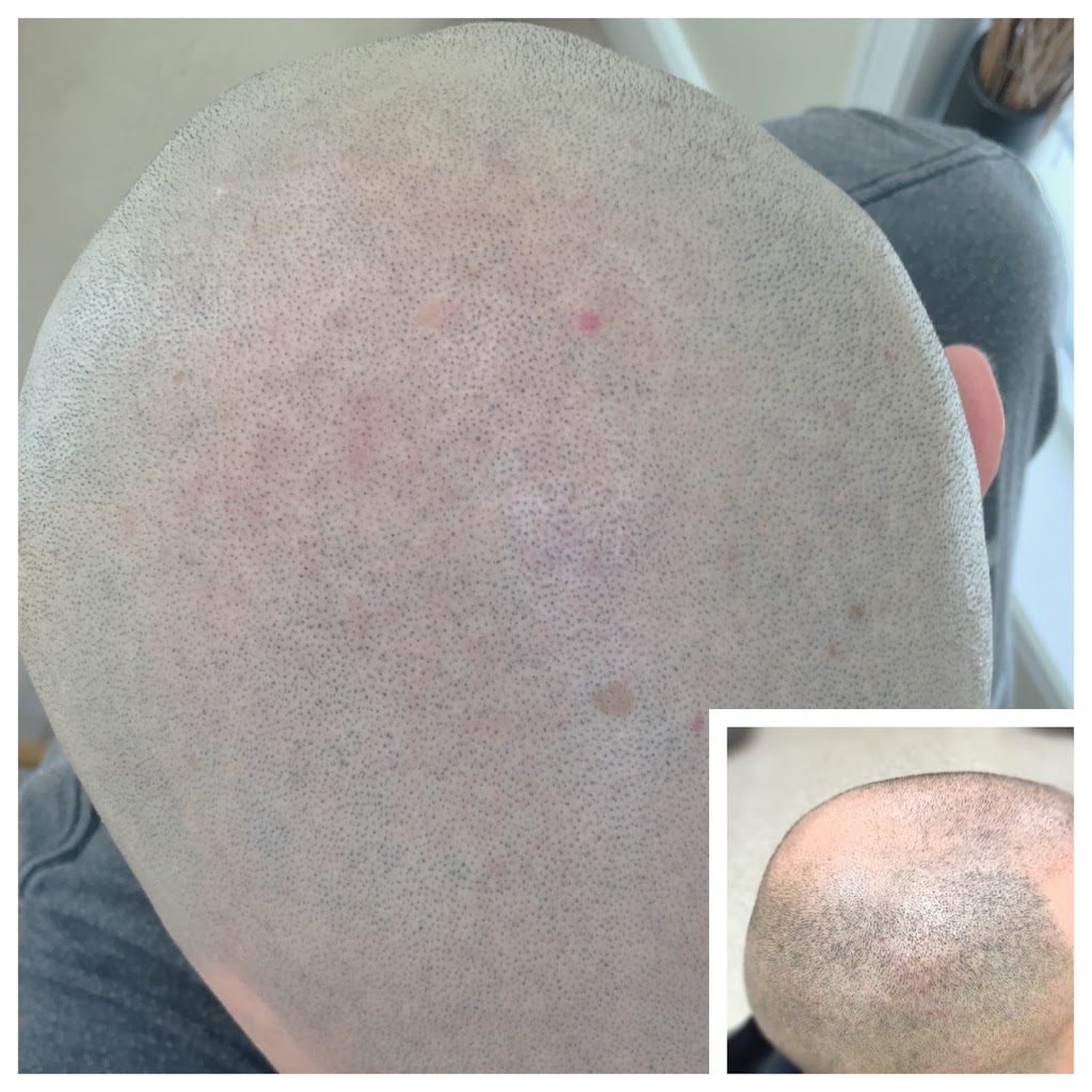 Ink2scalp | 6 Teardrop Crescent, Whitby, ON L1M 2N9, Canada | Phone: (905) 259-1251