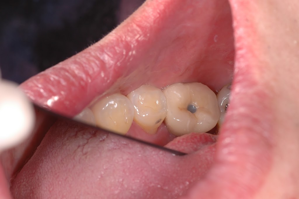 Chois Dental Studio | 1270 King St E, Cambridge, ON N3H 3P8, Canada | Phone: (289) 788-3996