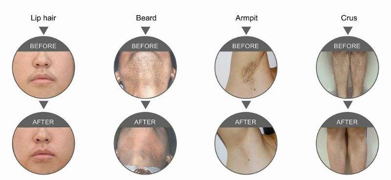Fabeez Skin Care & Laser Inc. | 1424 Crozier Crescent, Milton, ON L9T 6N1, Canada | Phone: (647) 530-7750