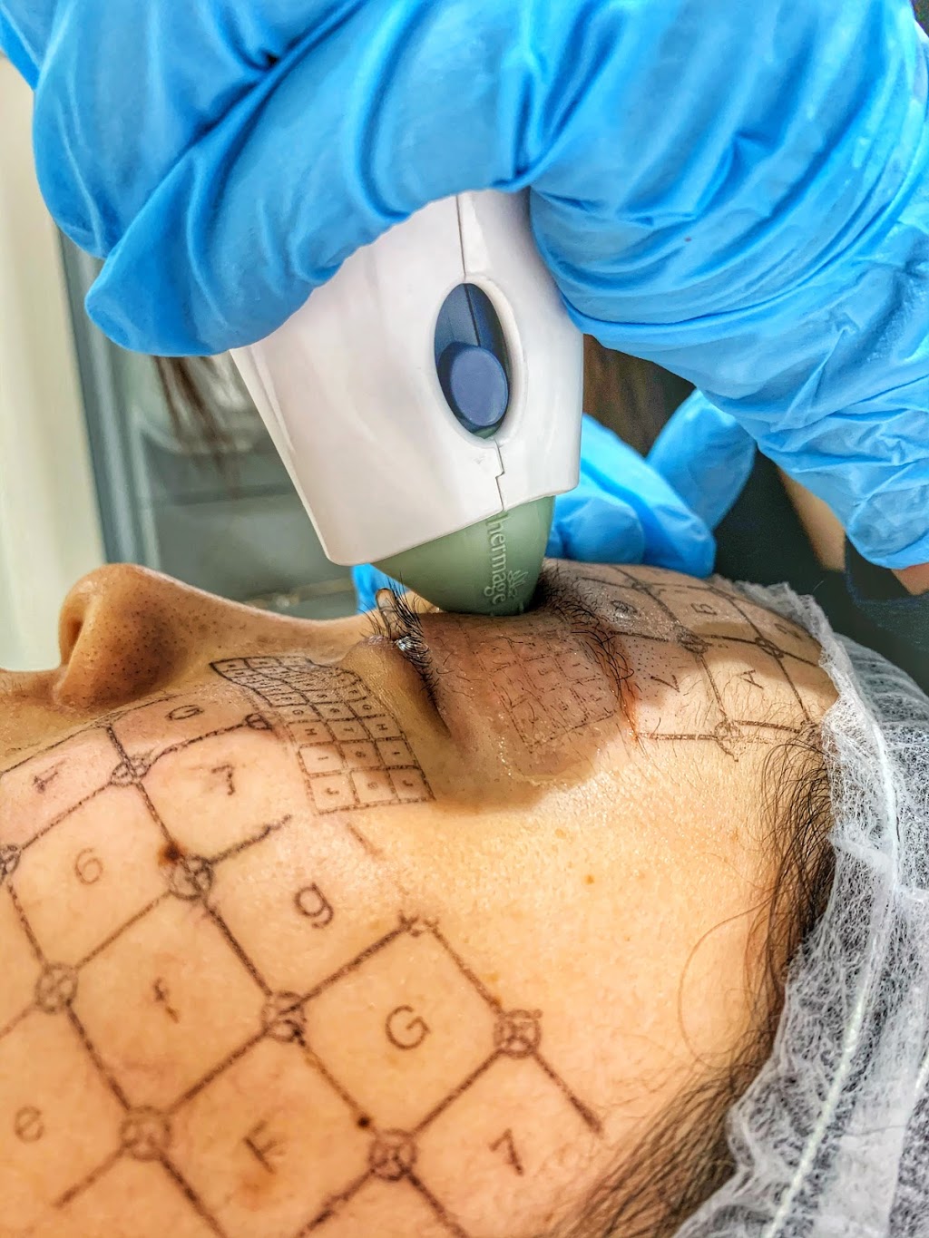 Mernov Medi Spa | 8500 Warden Ave, Markham, ON L6G 1A5, Canada | Phone: (905) 470-8522