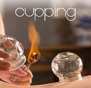 Acupuncture in Royal Vista | 164 Panamount Way NW, Calgary, AB T3K 0P7, Canada | Phone: (403) 993-3202