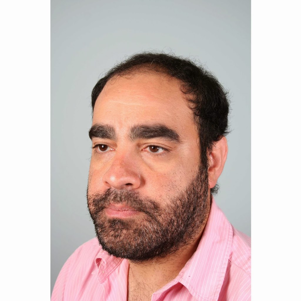 Canadian Hair Transplant Centre | 2863 Ellesmere Rd Suite #405, Scarborough, ON M1E 4B9, Canada | Phone: (416) 924-2482