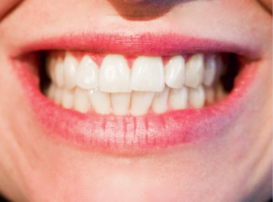 Marc Dupuis - Denturologiste Sherbrooke | 854 Rue McManamy, Sherbrooke, QC J1H 2N3, Canada | Phone: (819) 565-2971