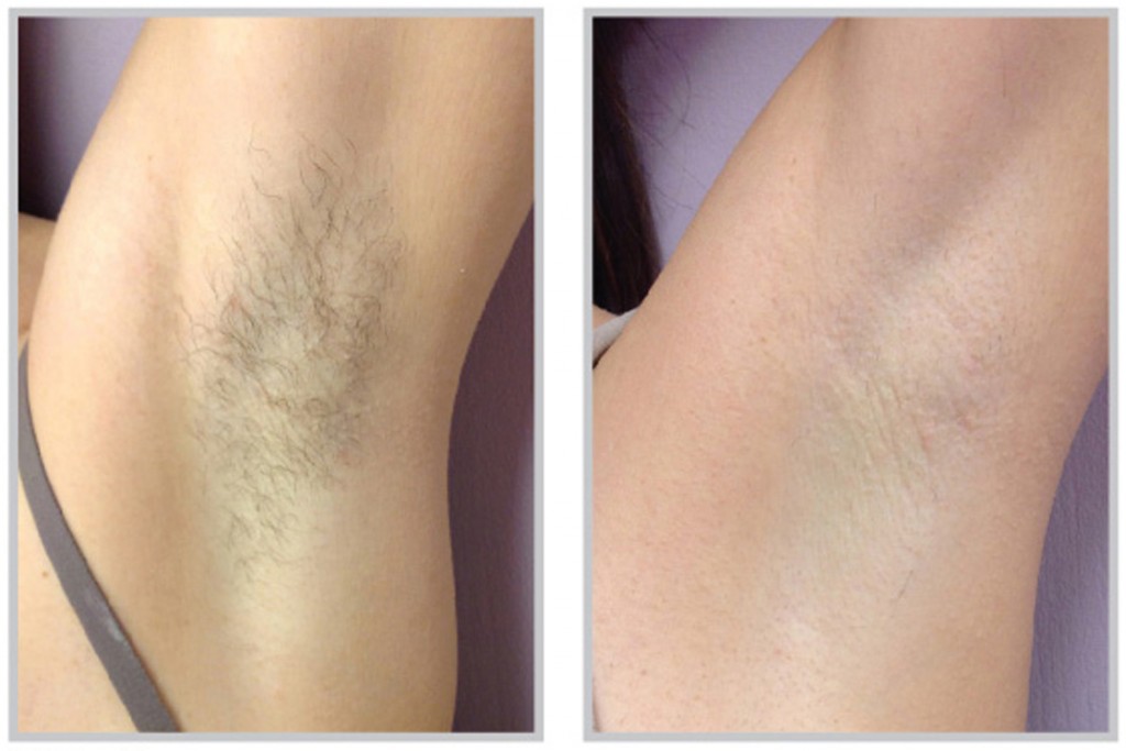 Erase Time 101 | 2 Brillinger St, Richmond Hill, ON L4C 8Y8, Canada | Phone: (647) 401-2079