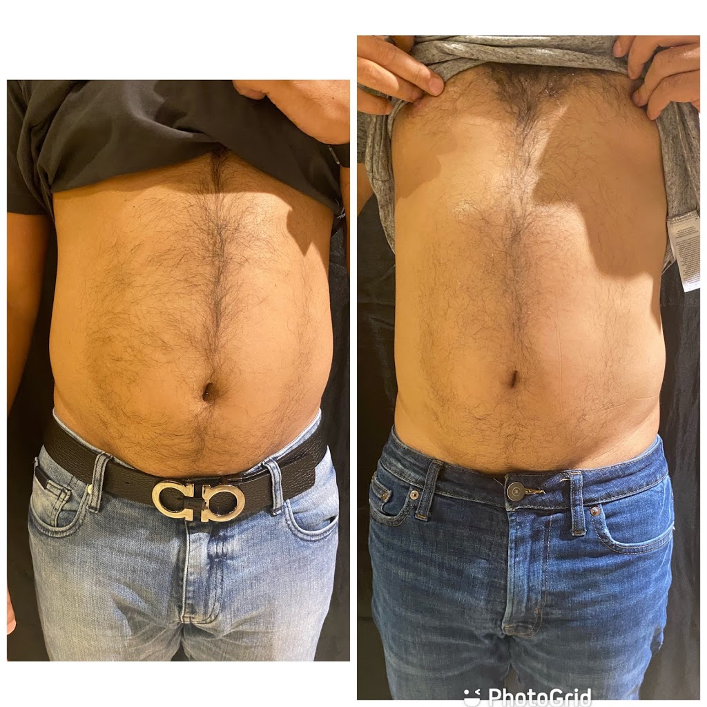 Body Perfection | 36 Tynevale Dr, Etobicoke, ON M9R 2B5, Canada | Phone: (647) 523-4526