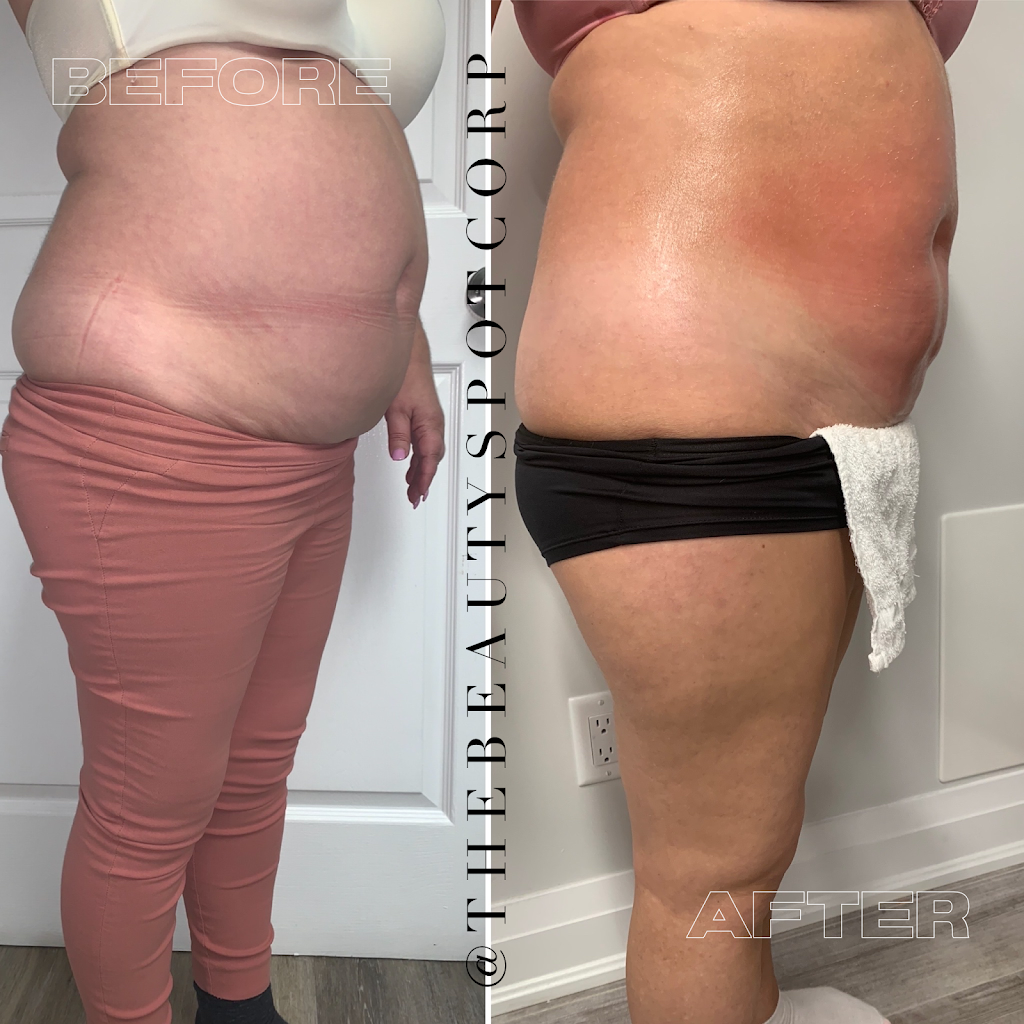 The Beauty Spot Corp. | 397 Kleinburg Smt Wy #1, Kleinburg, ON L4H 4T1, Canada | Phone: (647) 778-7356