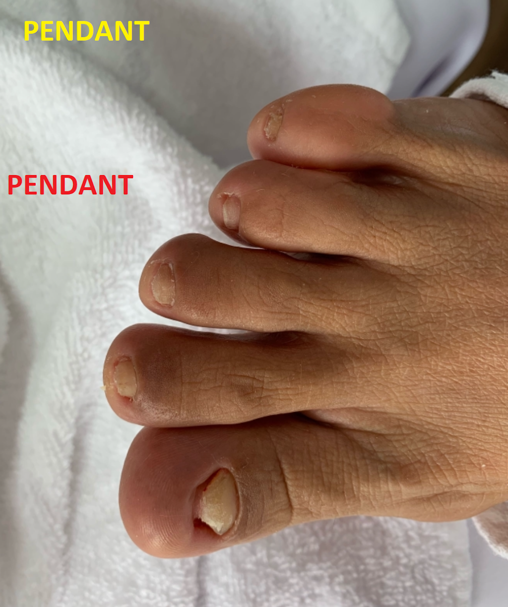 Vital-Pied - Soins podologiques (soins des pieds) | 16690 Rue des Quatre-Saisons, Mirabel, QC J7N 1J1, Canada | Phone: (819) 808-9259