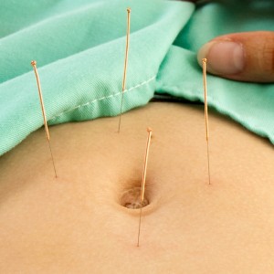 Monica Patt Acupuncture | A, 10118 124 St Second Floor, Edmonton, AB T5N 1P6, Canada | Phone: (780) 705-0444