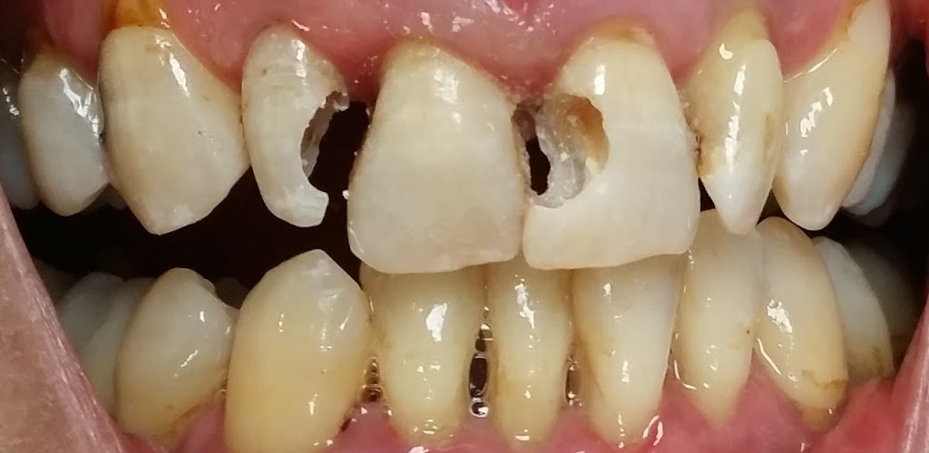 Kenedy Ruth Dental Centre | 27 Ruth Ave, Brampton, ON L6Z 4R2, Canada | Phone: (905) 846-1595