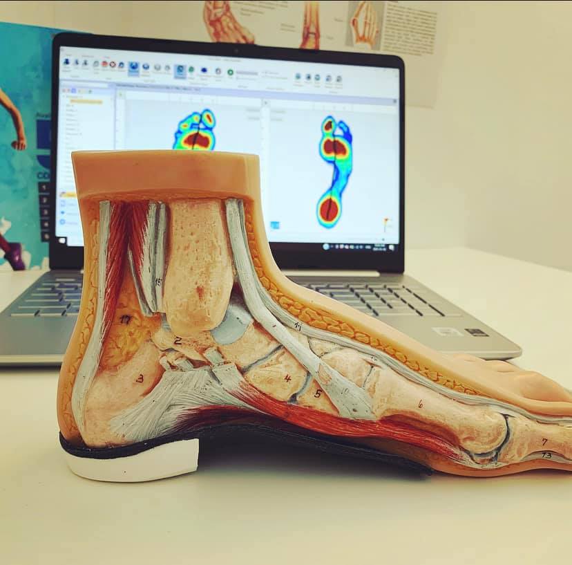 R3 Orthotics | 3009 26 Ave SW, Calgary, AB T3E 0M7, Canada | Phone: (403) 454-4806