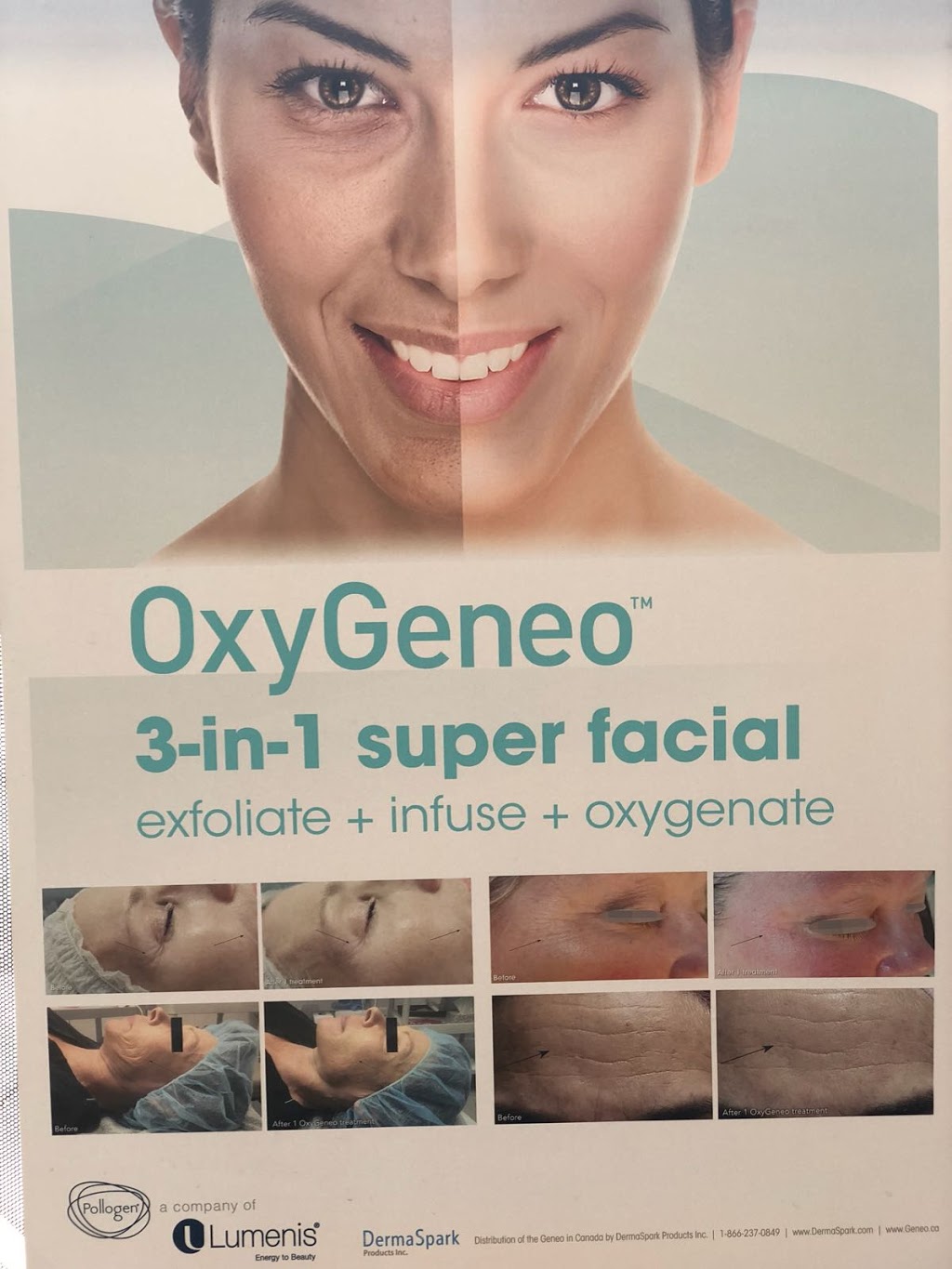 The Paris Laser Clinic | 10970 Bramalea Rd, Brampton, ON L6R 0C1, Canada | Phone: (647) 327-2747
