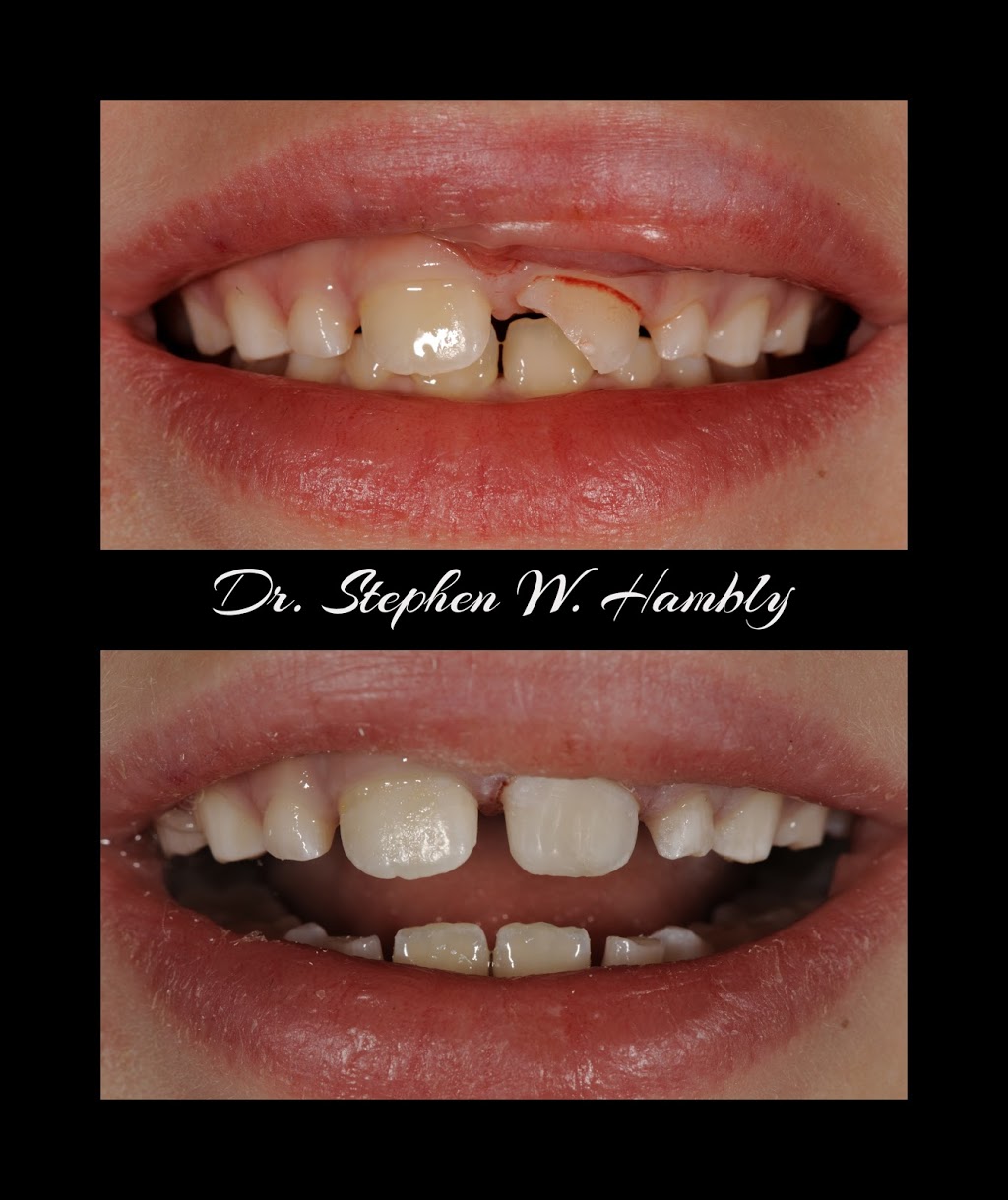 Ancaster Dental Care | 34 Stone Church Rd Suite 202, Ancaster, ON L9K 1S5, Canada | Phone: (905) 304-3479
