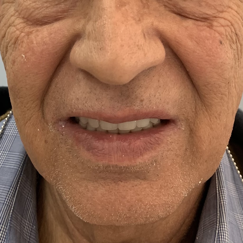 KIM DENTURE CLINIC | 12565 88 Ave #105, Surrey, BC V3W 3J7, Canada | Phone: (778) 222-7447