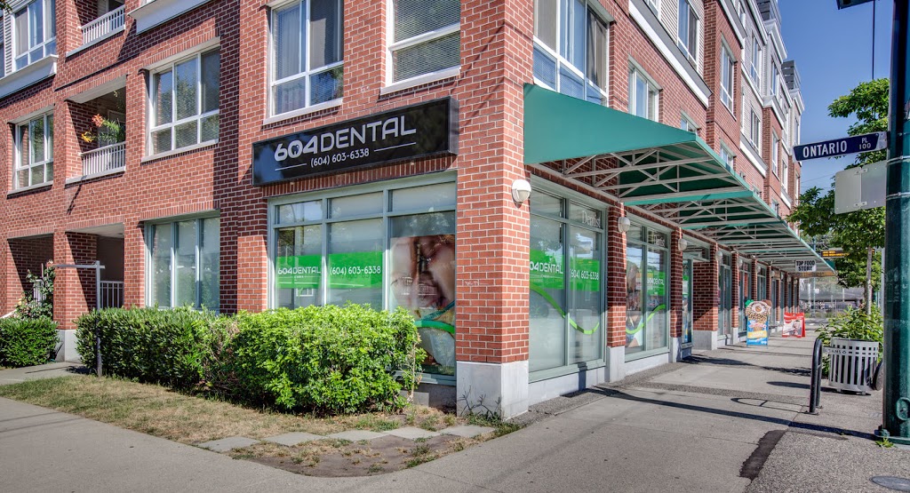 604 Dental - Main 41 Dentist | 5733 Main St, Vancouver, BC V5W 4C7, Canada | Phone: (604) 322-7483