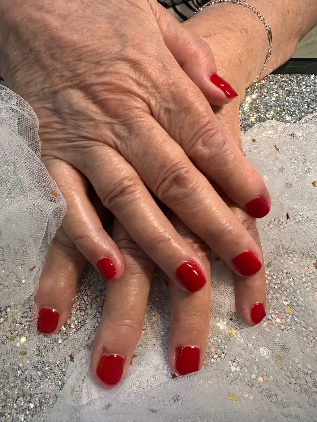 Alexandra Esthétique | 16 Westminster Ave N #205, Montreal West, QC H4W 1Y8, Canada | Phone: (514) 910-2125