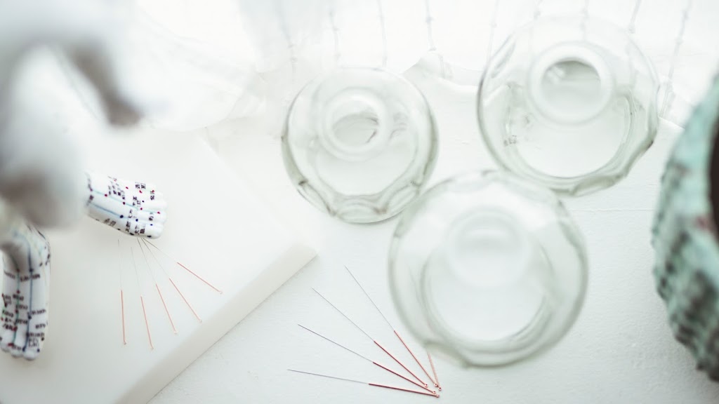 Acupuncture with Madison | 213 19 St NW #4, Calgary, AB T2N 2H9, Canada | Phone: (403) 283-0725