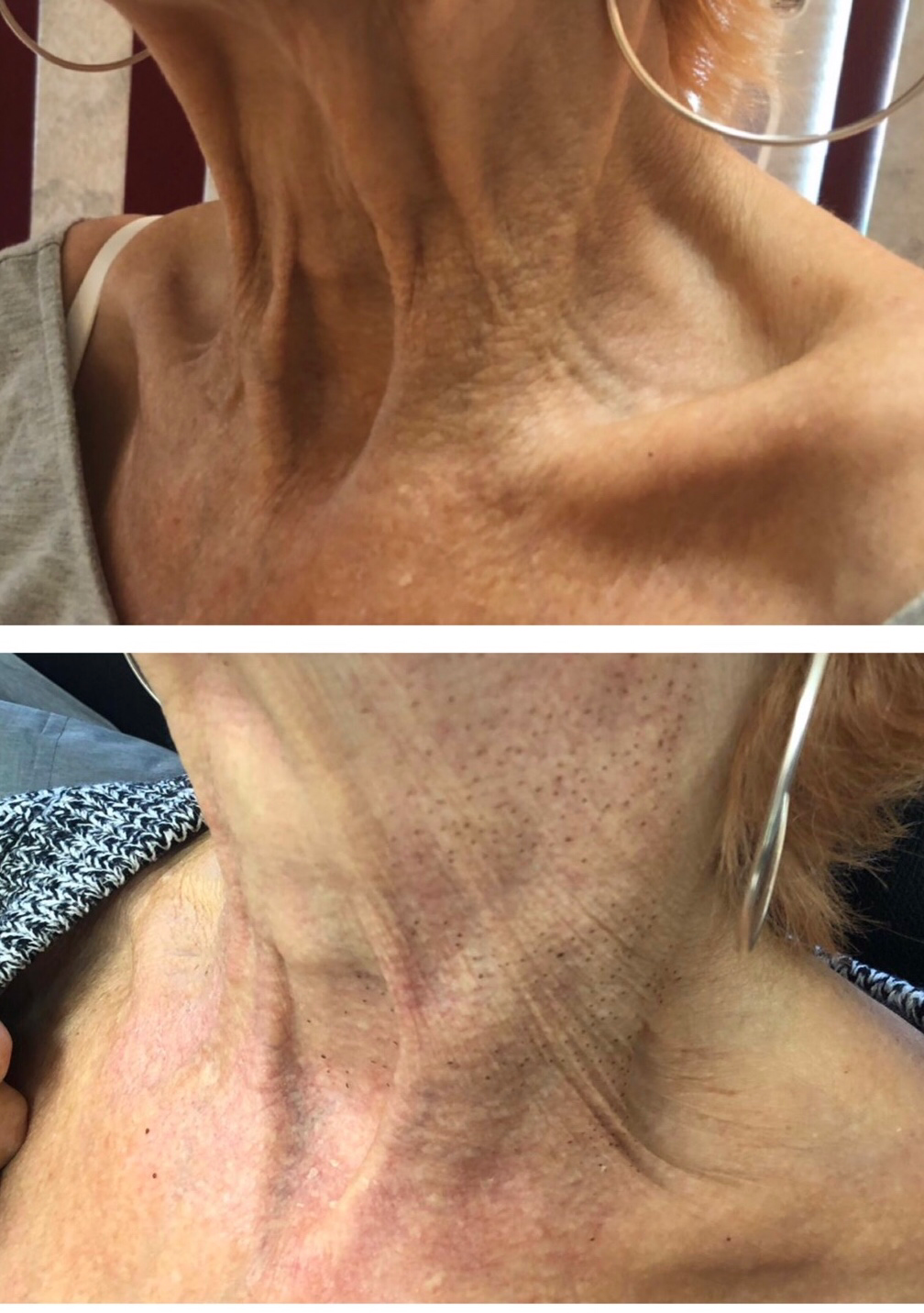 Ageless Medical Cosmetic Clinic | 1100 Dundas St W unit 1, Mississauga, ON L5C 4E7, Canada | Phone: (647) 951-5392