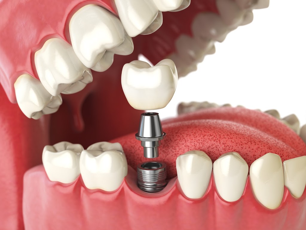 The Dental Place | 642 Upper James St, Hamilton, ON L9C 2Z2, Canada | Phone: (905) 574-9617