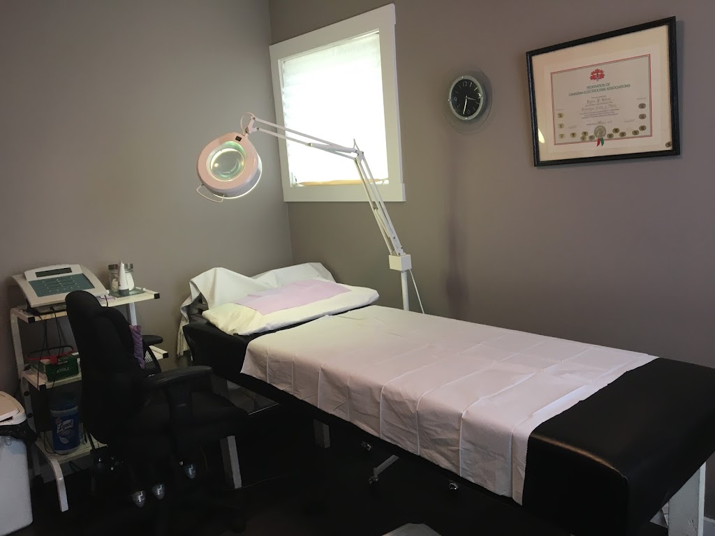 Elite Electrolysis Clinic | 12011 127 St NW, Edmonton, AB T5L 0Z5, Canada | Phone: (780) 420-1443