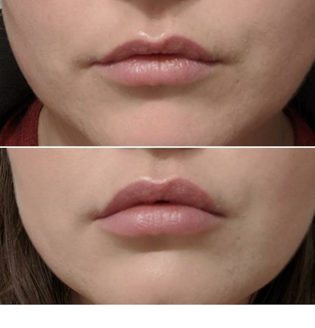 Empowered Medical Aesthetics Co. | 353 Manly St, Midland, ON L4R 3E1, Canada | Phone: (519) 216-8673