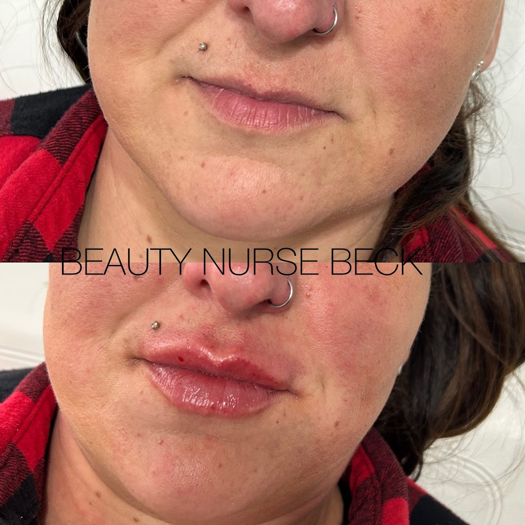 Beauty Nurse Beck - Seaforth | 39 Main St S, Seaforth, ON N0K 1W0, Canada | Phone: (226) 338-9202