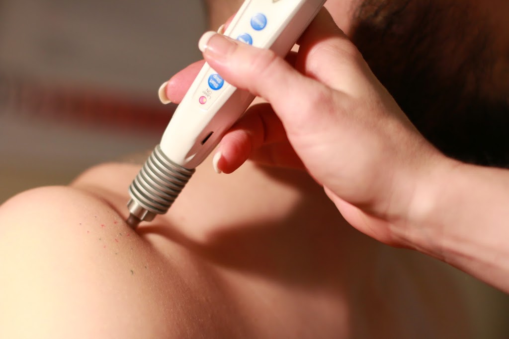 Laserotherapie 3001 Anjou / Auriculothérapie / Martine Bourgeaul | 6933 Rue Beaubien E, Montréal, QC H1M 3B2, Canada | Phone: (514) 543-3444