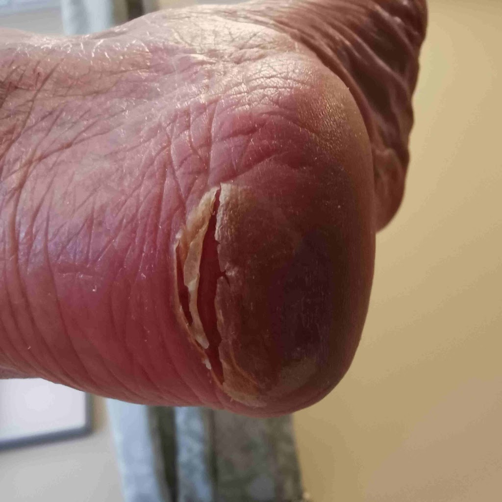 2fixfeet | 187 Lynnbrook Crescent, Waterloo, ON N2L 4X2, Canada | Phone: (519) 722-2045