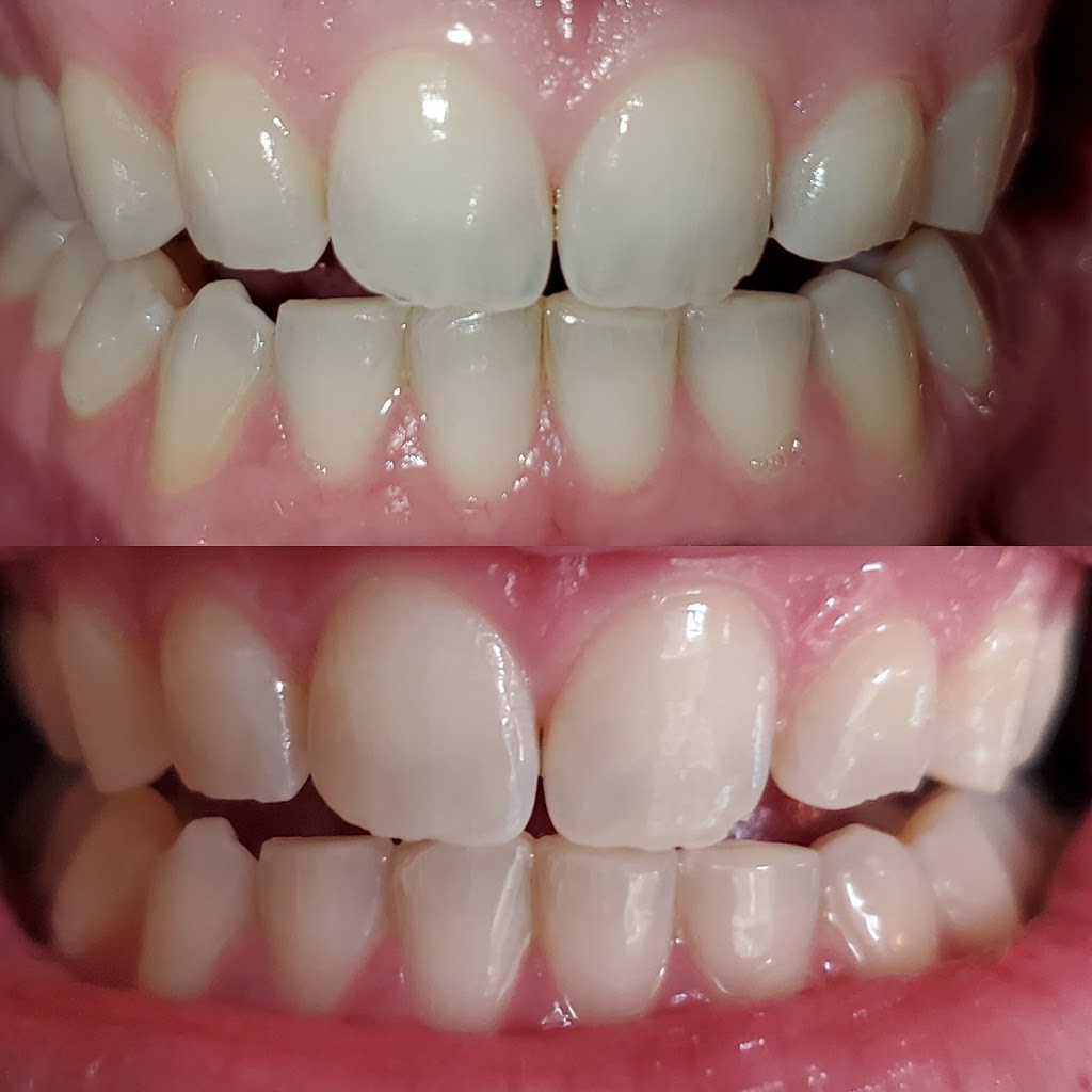 Whitening At Tiffanys | 46 Hannon Cres, Hannon, ON L0R 1P0, Canada | Phone: (905) 920-1398