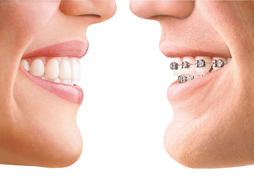 Hakeem Dental | 2250 Bovaird Dr E #105, Brampton, ON L6R 0W3, Canada | Phone: (905) 792-9922