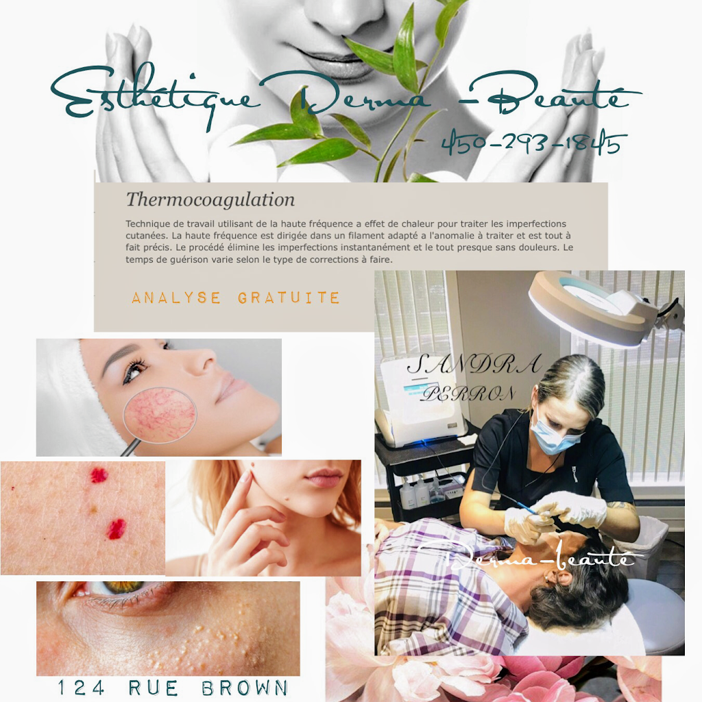 Esthétique Derma-beauté | 124 Rue Brown #1, Cowansville, QC J2K 2A9, Canada | Phone: (450) 293-1845