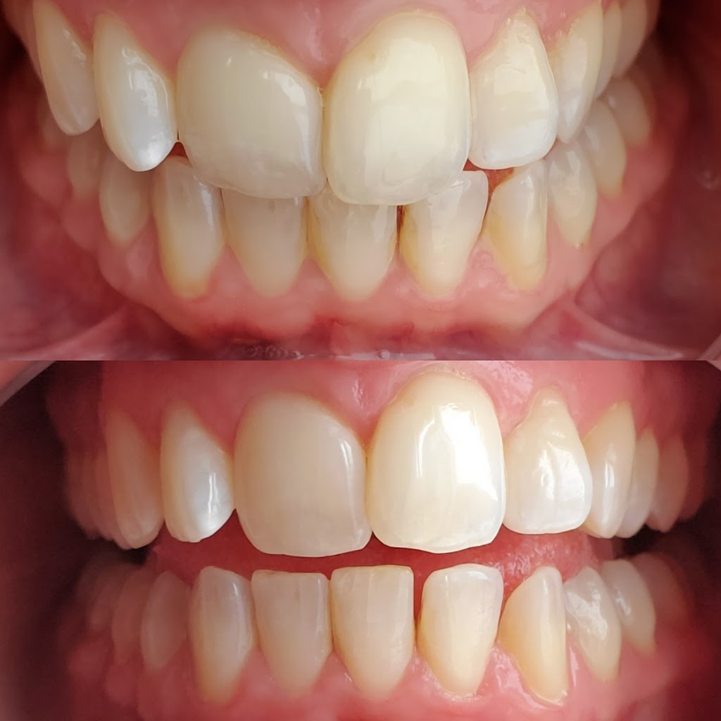 Whitening At Tiffanys | 46 Hannon Cres, Hannon, ON L0R 1P0, Canada | Phone: (905) 920-1398